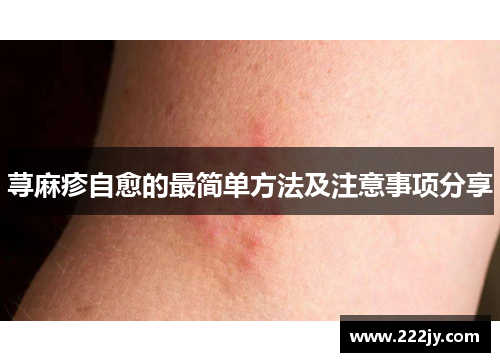 荨麻疹自愈的最简单方法及注意事项分享